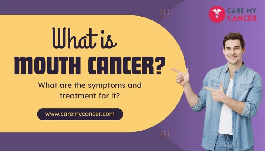 What is mouth cancer