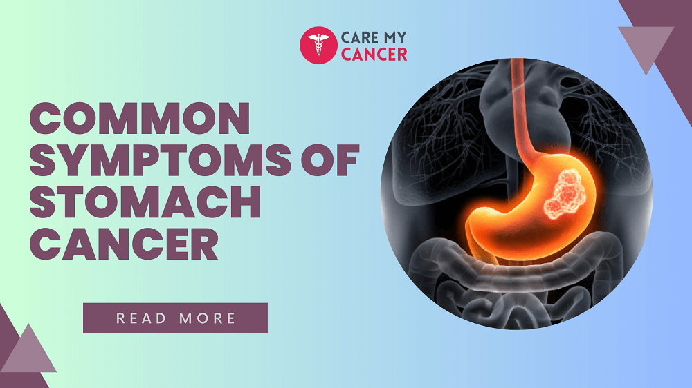 stomach cancer symptoms