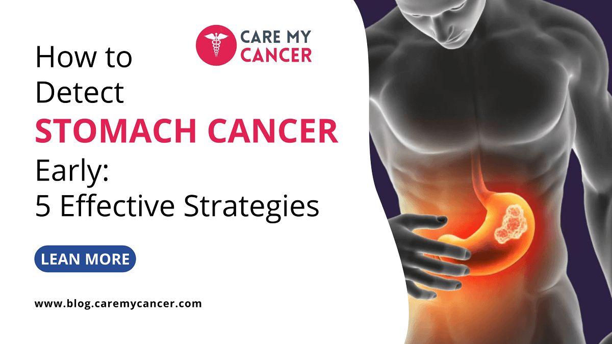 How to Detect Stomach Cancer Early: 5 Effective Strategies