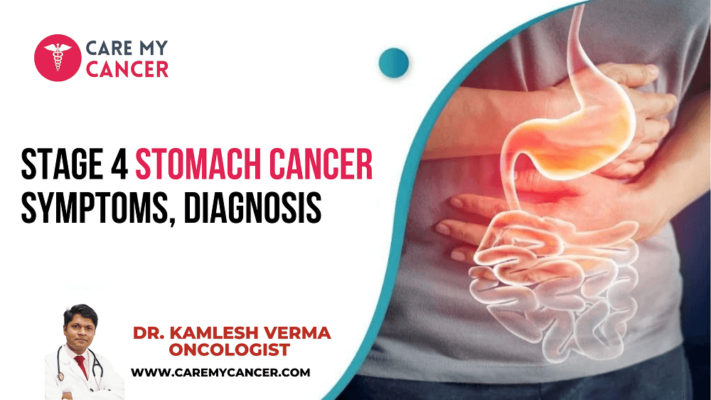 Stage 4 Stomach Cancer