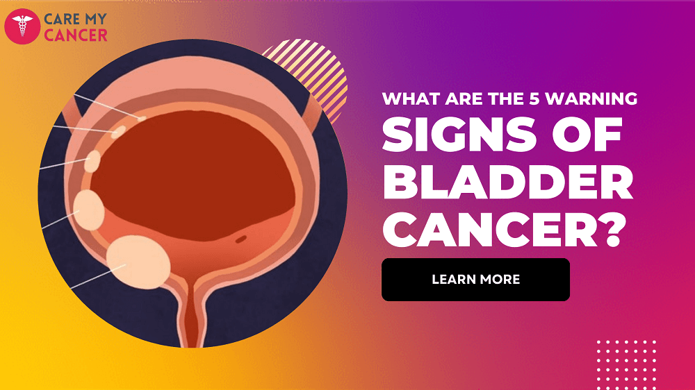 signs of bladder cancer