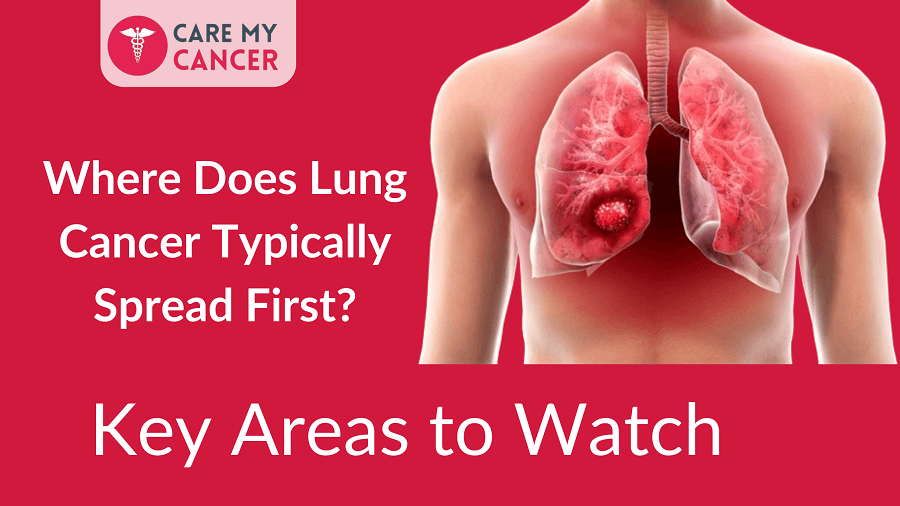 Where Does Lung Cancer Typically Spread First