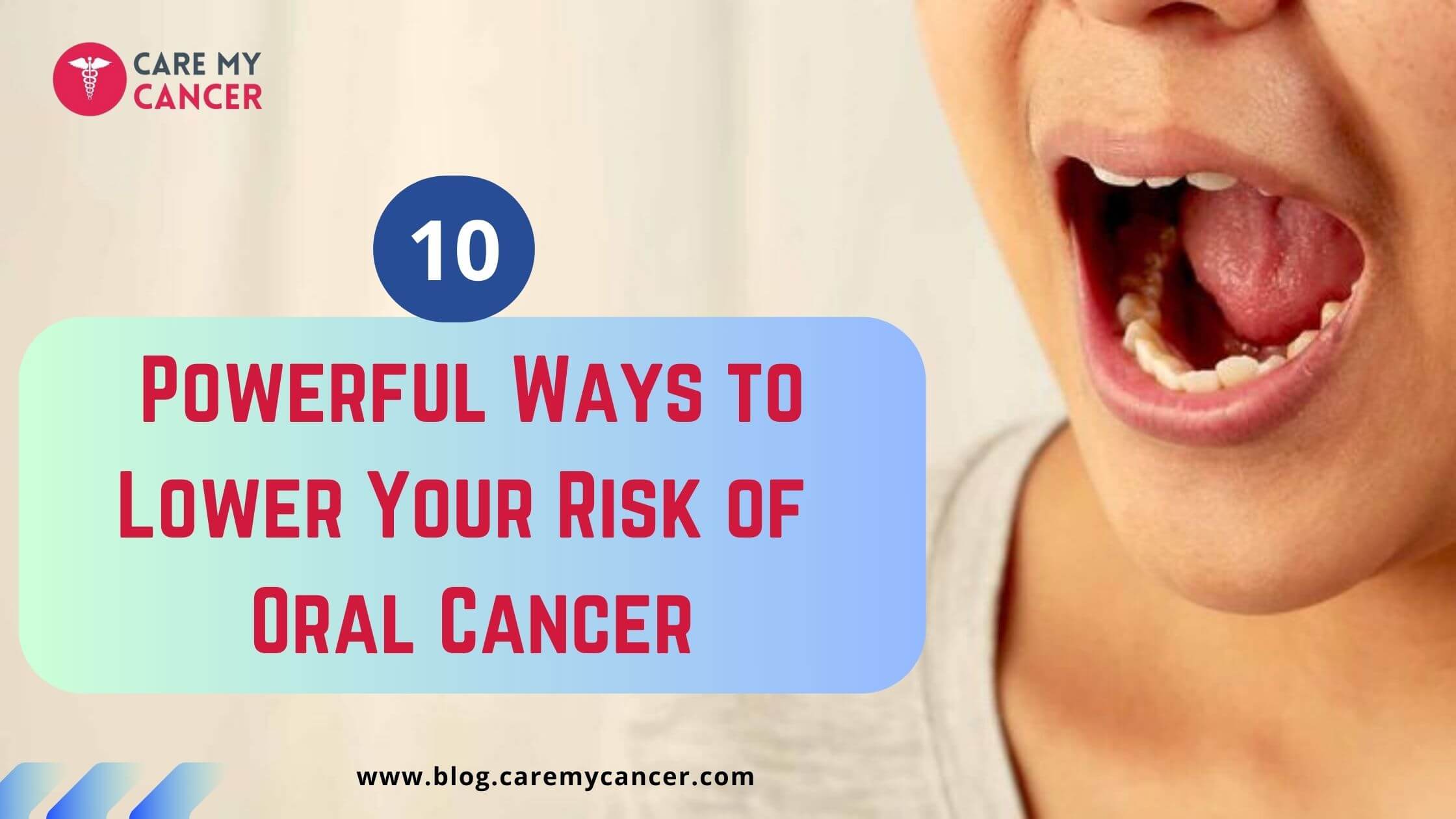 oral cancer