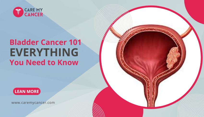 Bladder Cancer 101