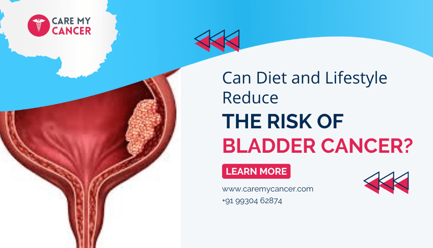 bladder cancer risk