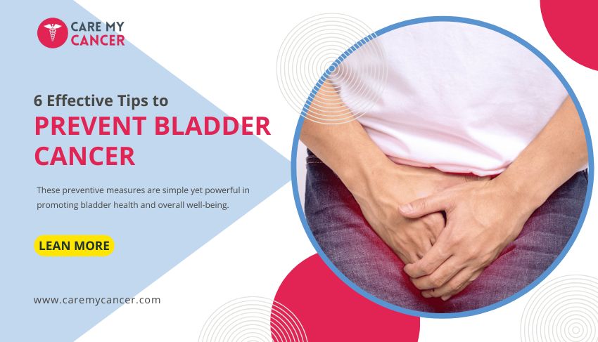 prevent bladder cancer