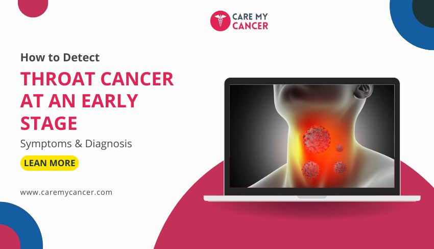 Throat Cancer at an Early Stage