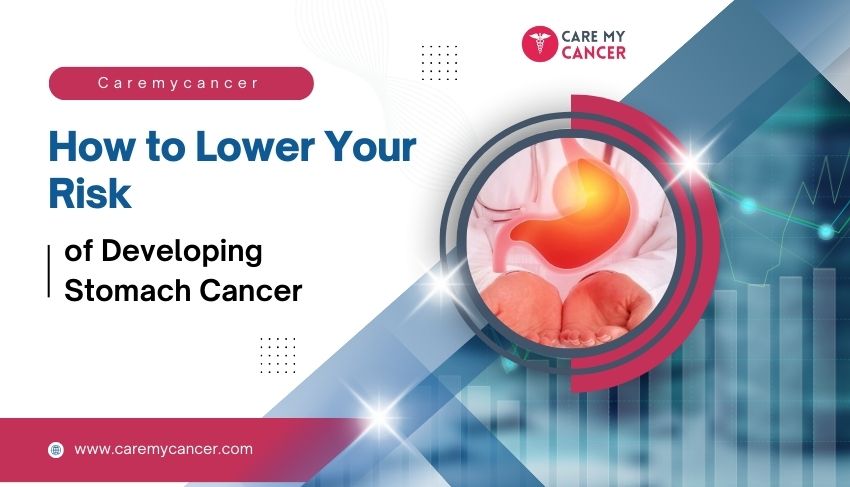 Stomach cancer