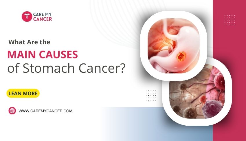 What Are the Main Causes of Stomach Cancer