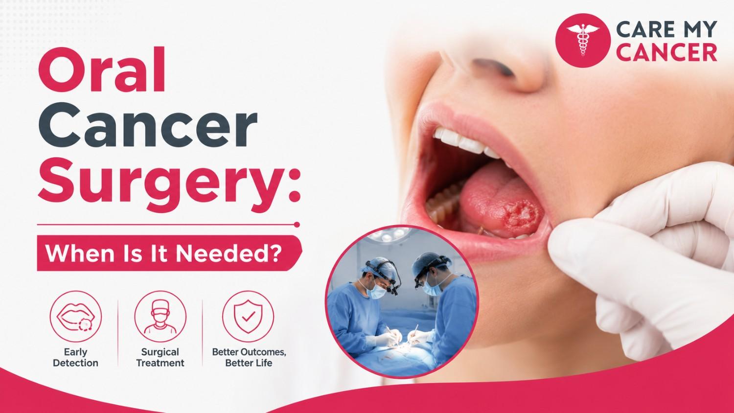Oral Cancer Surgery