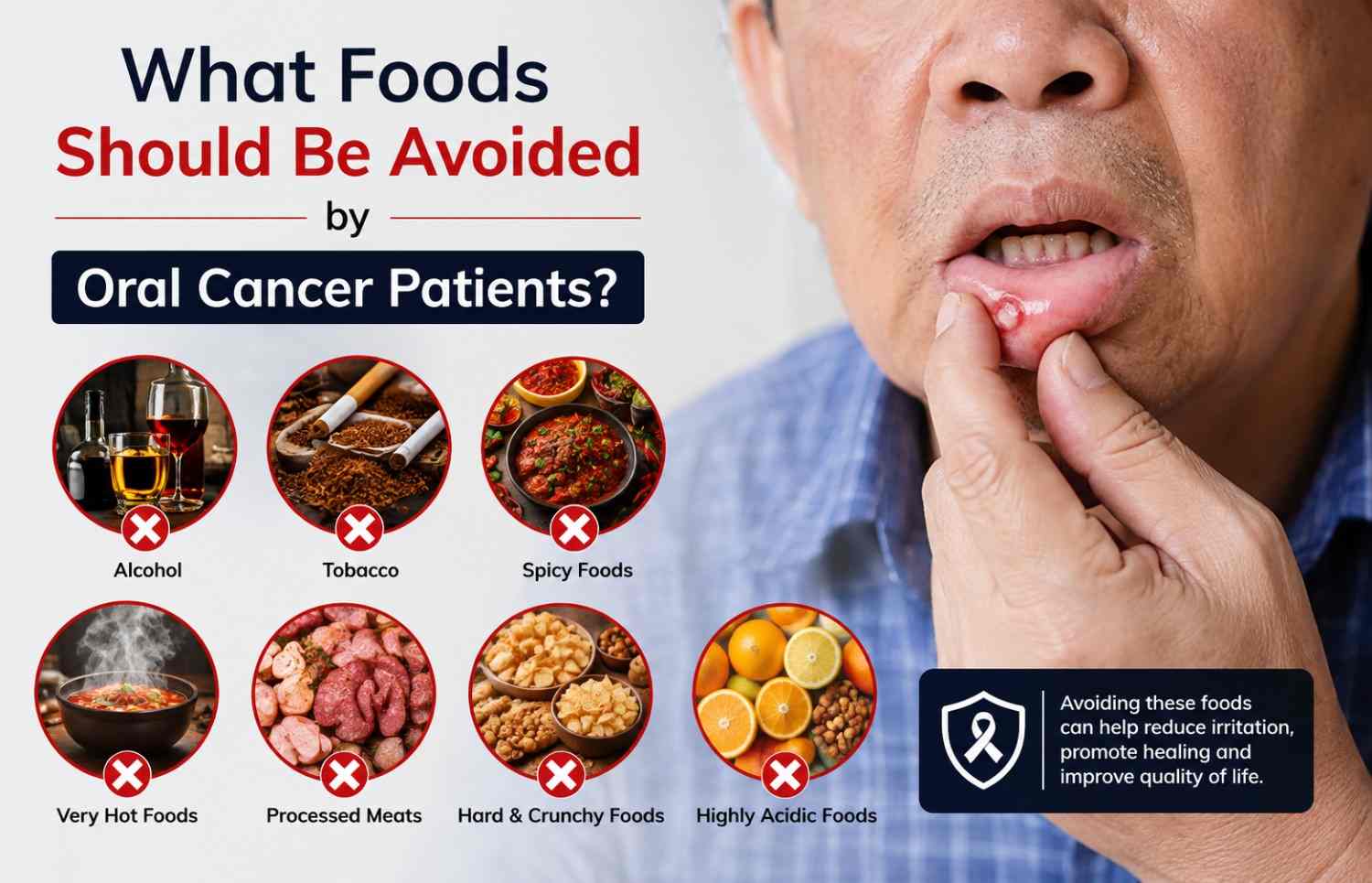oral cancer patients